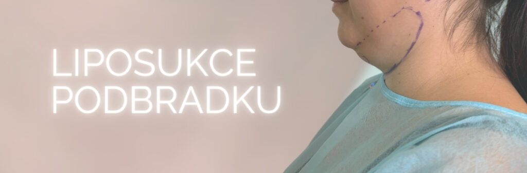 LIPOSUKCE PODBRADKU, CBP KLINIKA