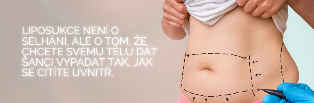 liposukci břicha