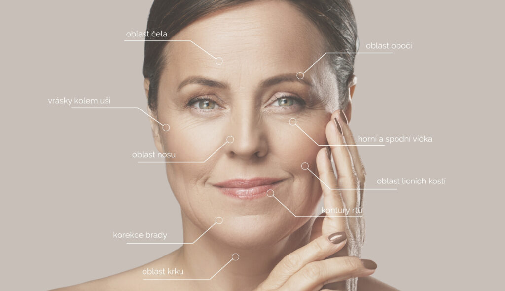 Niťový lifting Aptos